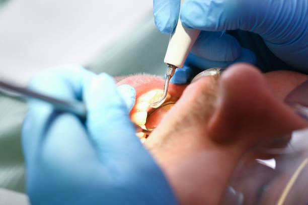 Best Emergency Tooth Extraction in White Hall, WV