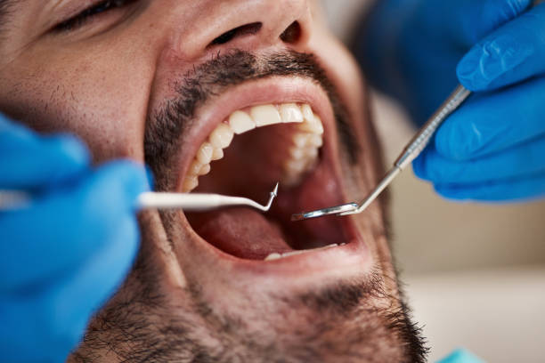 Best After-Hours Emergency Dentist in White Hall, WV