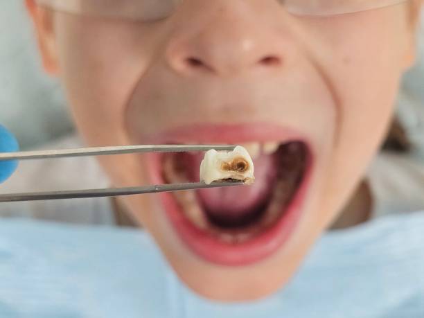 Best Emergency Orthodontic Repairs in White Hall, WV