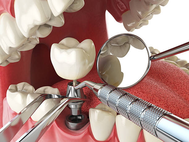 Best Emergency Dental Surgery in White Hall, WV